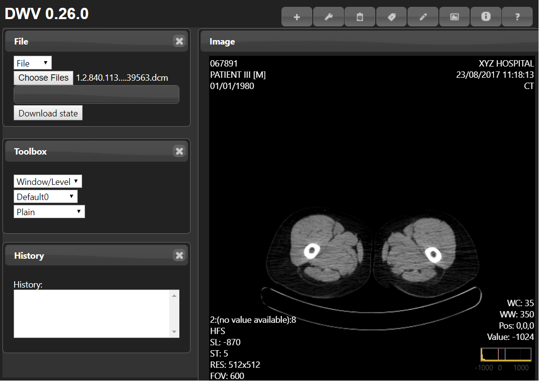 DicomWebViewer - Presented by PostDICOM